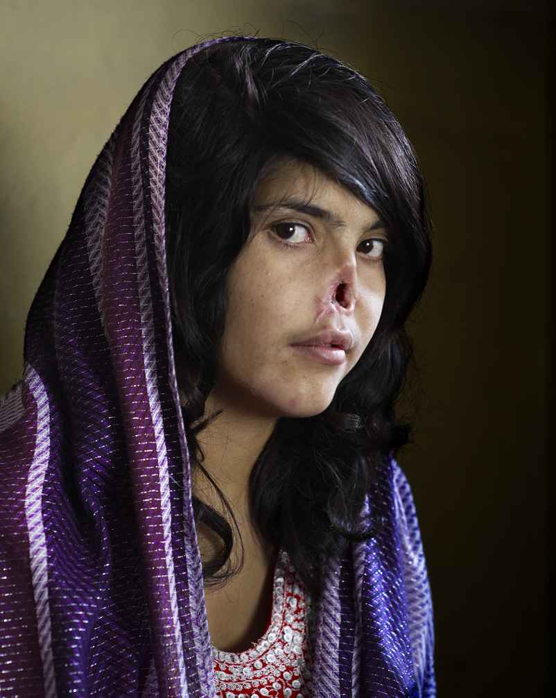 World Press Photo 2010/ Jodi Bieber, South Africa, Institute for Artist Management/Goodman Gallery for Time Magazine.